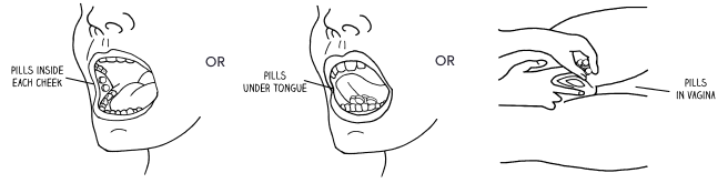 Toma misoprostol
